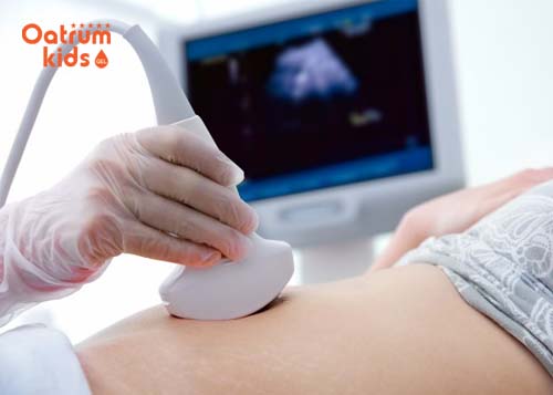  Không có tim thai rất có thể do thai bị sảy và chết lưu.