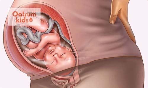 Thai 35 tuần đã xoay đầu và tụt xuống thấp dưới âm đạo.