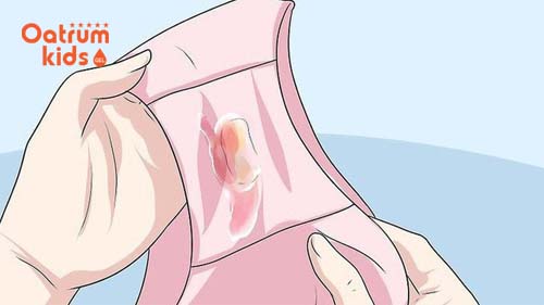 Mẹ sắp chuyển dạ thường ra dịch nhày có lẫn máu.