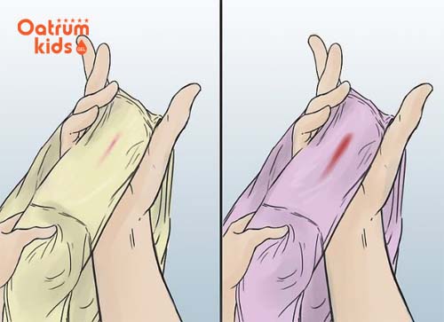 Khí hư khi mang thai có màu trắng, không mùi, màu hơi vàng.