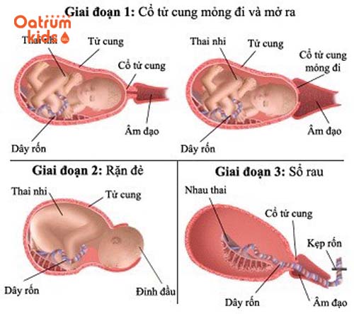 3 giai đoạn quan trọng của quá trình sinh con.