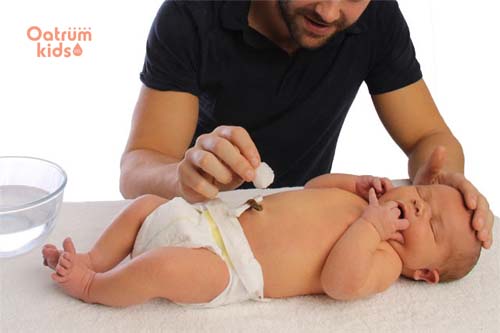  Vệ sinh rốn trẻ sơ sinh đúng cách