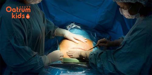 Ảnh bác sĩ thực hiện quy trình mổ đẻ cho sản phụ