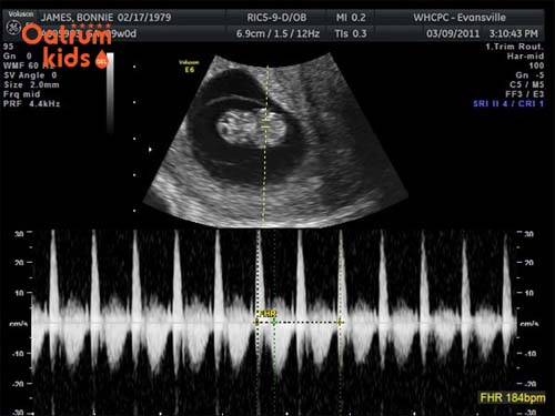  Thai 10 tuần tuổi đã biết đạp và vặn mình.