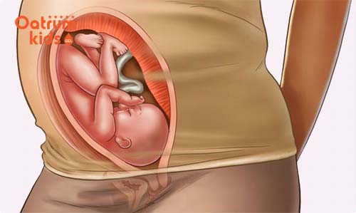 Vị trí thai máy sẽ giúp mẹ chẩn đoán thai đã xoay đầu hay chưa.