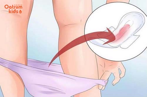 Vệ sinh sạch sẽ vùng kín và tránh quan hệ tình dục.