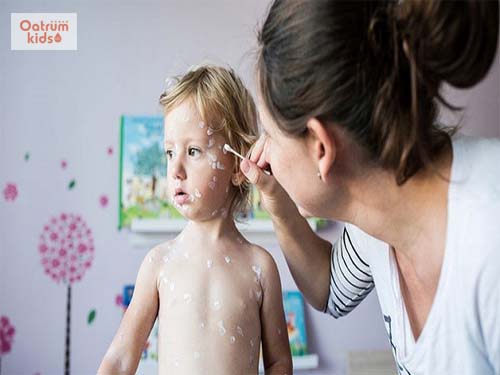  Sử dụng các loại thuốc bôi ngoài da để điều trị bệnh