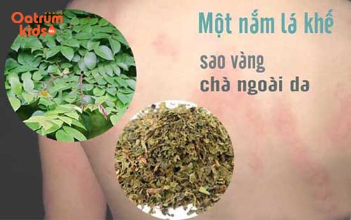 Lá khế chữa mề đay thực hiện theo 3 cách