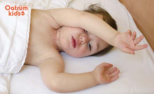 Nấm da cũng làm nổi mẩn đỏ ở cổ trẻ sơ sinh