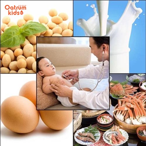 Nếu trẻ bị dị ứng mẩn ngứa do thực phẩm cần thay đổi chế độ dinh dưỡng cho con