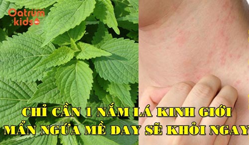 Bài thuốc trị mề đay mẩn ngứa từ lá kinh giới