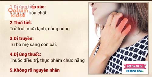  Trẻ bị nổi mề đay do rất nhiều nguyên nhân khác nhau.