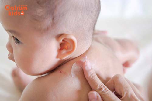 Nên sử dụng các loại kem dưỡng ẩm tốt cho trẻ