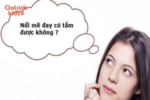 Nổi mề đay có được tắm không là thắc mắc của nhiều người bệnh