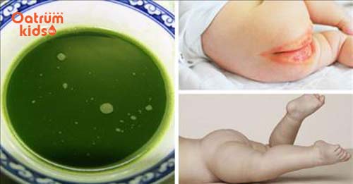 Khế là loại cây rất gần gũi với người dân Việt Nam - Trị hăm tã bằng lá khế