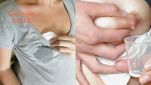 Sữa mẹ là chất lòng vô trùng nên có khả năng làm lành vết thương