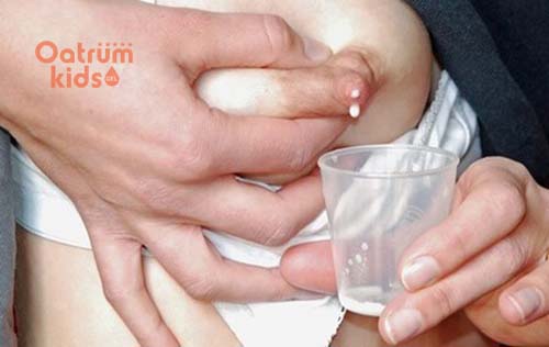 Chữa nứt cổ gà bằng sữa mẹ