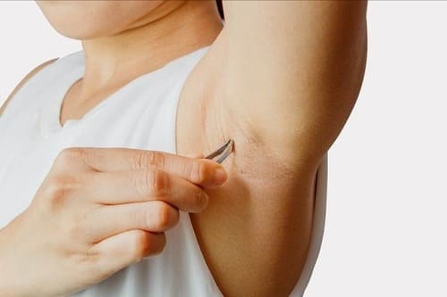 Dùng nhíp hoặc dao cạo nhổ lông nách gây mụn mủ