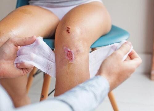 Đến ngay cơ sở y tế để được thăm khám và điều trị kịp thời