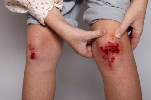 Vết thương bị đau tăng dần