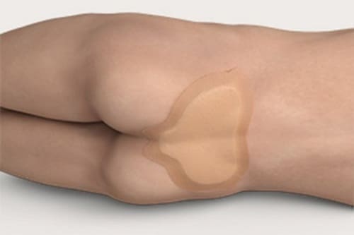 Vết loét vùng xương cùng trải qua 4 giai đoạn với mức tổn thương khác nhau