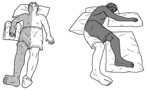 Cứ 2 tiếng thay đổi tư thế 1 lần để giảm áp lực tì đè