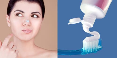 Trị mụn trứng cá bằng kem đánh răng là phương pháp lỗi thời, tiềm ẩn nhiều nguy cơ