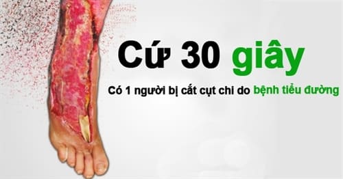 Biến chứng ngứa da có thể dẫn tới đoạn chi