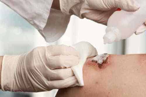 Tiến hành sát trùng vết thương