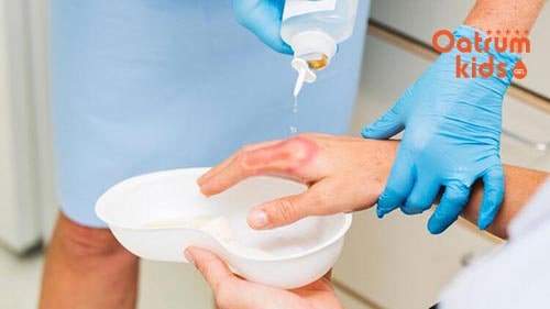 Sát trùng vết thương bỏng bô xe máy bằng nước muối sinh lý