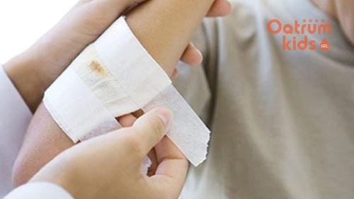 Thay băng thường xuyên cho trẻ để giữ vệ sinh