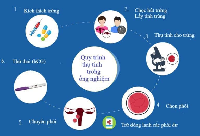 Quy trình thụ tinh trong ống nghiệm ở mỗi nơi thực hiện sẽ khác nhau