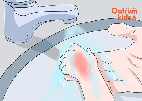 Xả nước vào vết bỏng là việc đầu tiên và quan trọng nhất cha mẹ cần làm