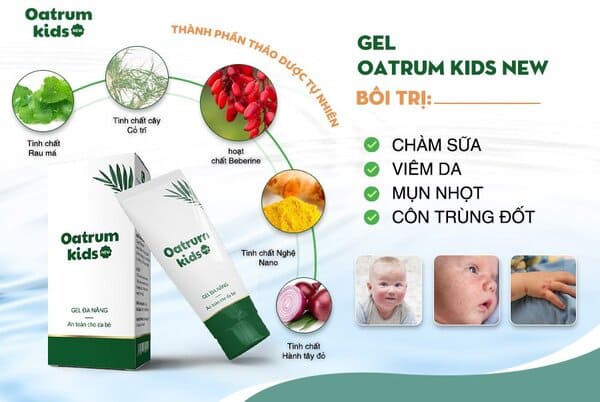 Top 6 loại kem trị hăm cho bé an toàn, hiệu quả mẹ nào cũng tin dùng