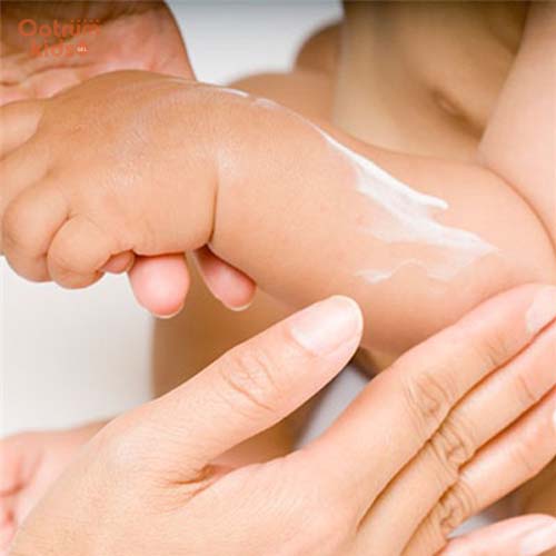 Bé bị rôm sảy có mủ - Kem bôi có chứa corticoid gây kích ứng, nhiễm trùng da bé
