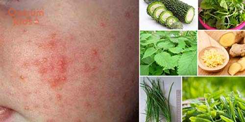 Cần rửa hết bụi bẩn, trứng côn trùng trước khi nấu lá tắm trị rôm sảy cho bé