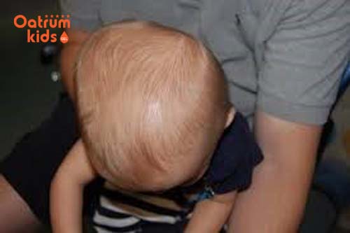 Thóp trẻ sơ sinh có chức năng bảo vệ bộ não