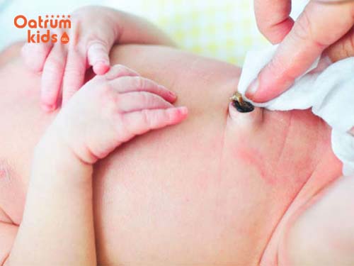  Chăm sóc rốn trẻ sơ sinh khi đã rụng rốn