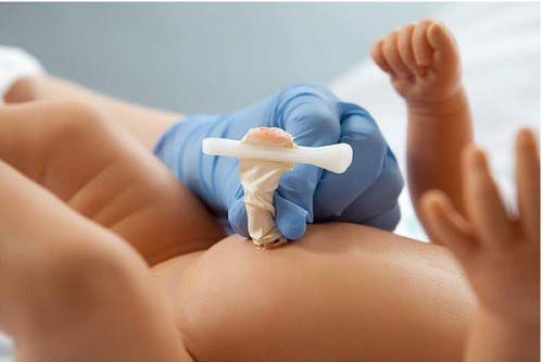  Chăm sóc rốn cho trẻ sơ sinh