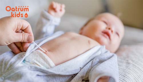  Vệ sinh rốn cho trẻ sơ sinh