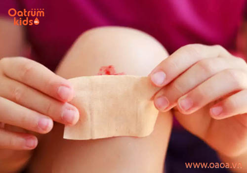 Vết trầy xước ở chân sẽ chậm lành hơn các vị trí khác