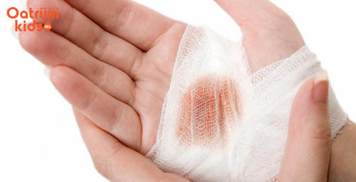 Dùng gạc vô trùng đắp lên vết trầy xước giúp mau lành, hạn chế sẹo xấu