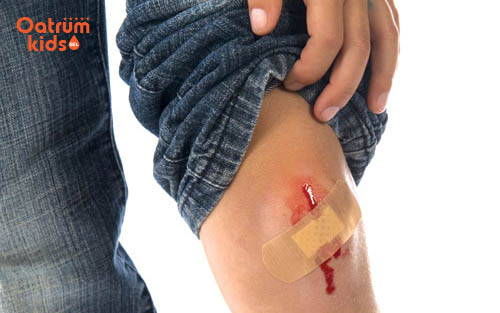 Vết trầy xước chảy máu, mủ, có mùi hôi