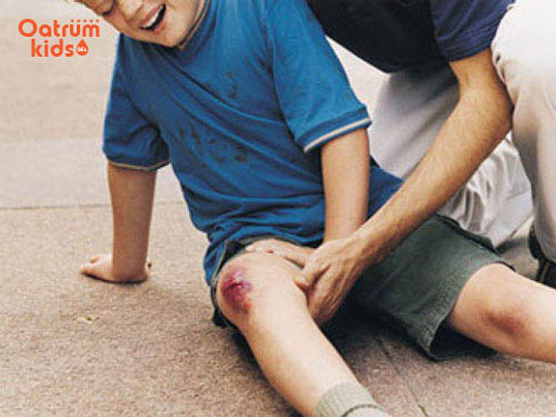 Vết thương quá nặng cần đưa trẻ đến cơ sở y tế