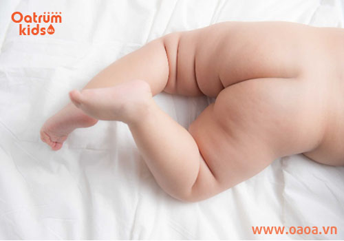 Bé cần được “nude” khi bị hăm tã ghé thăm