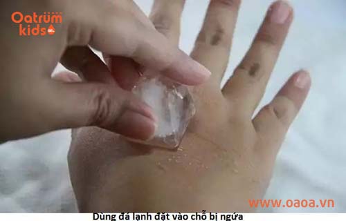 Đá lạnh giúp trẻ giảm nhanh cảm giác ngứa, sưng