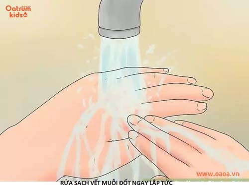 Vùng da bị côn trùng đốt cần được rửa sạch