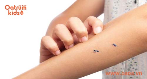 Muỗi đốt gây sưng đỏ, ngứa