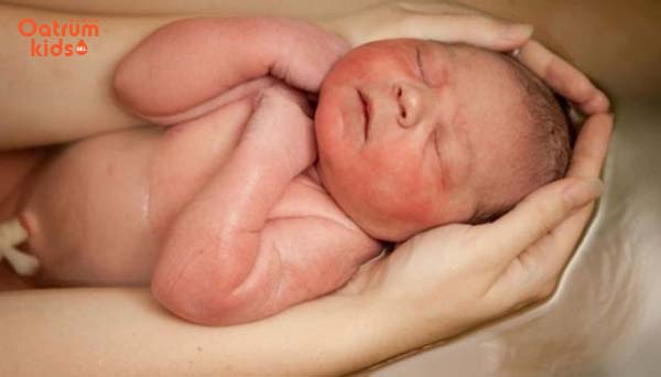 Tỷ lệ trẻ bị chàm sữa ngày càng gia tăng