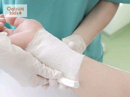 5 bước xử trí bỏng nhiệt chuẩn theo hướng dẫn của chuyên gia